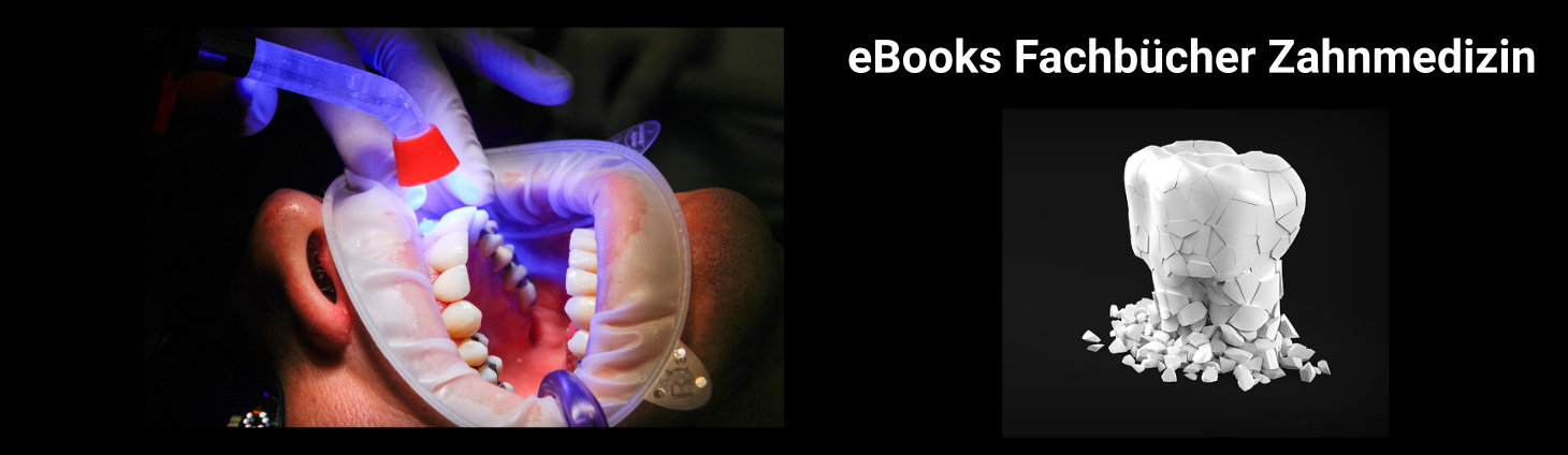 eBooks Fachbücher Zahnmedizin